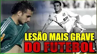 OLHA QUE TRISTE O QUE ACONTECEU COM MAIKON LEITE QUE ERA UM DOS MELHORES ATACANTES DO BRASIL