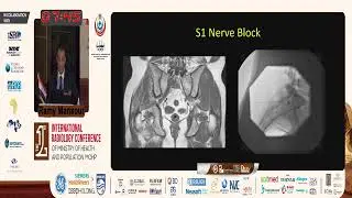 Image-guided Spinal Intervention