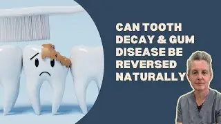 Can Dentistry Really Prevent Tooth Decay and Gum Disease [Holistic Dentists Brisbane]