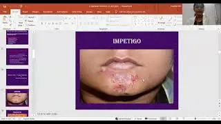 Bacterial Skin Infections - Dr. Niji Sara Jacob