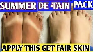 REMOVE SUNTAIN+GET FAIR SKIN WHITENING INSTANT GLOW.