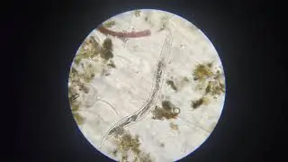 Necator americanus