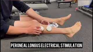 Peroneal longus electrical stimulation in patients with chronic ankle instability