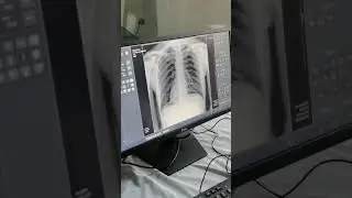 An X-ray machine that can take chest X-rays #xraymachine