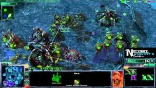 Tingywingy(Z) vs AxisHaDeZ(P) - [Part 2/2] - Thai Commentary (NotyNote)