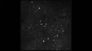 Activity of a cortical neuronal population visualized by two-photon calcium imaging