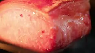 How to cook our  Rind On Traditional Dry Cure Bacon