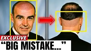 Golden Age Stars With the WORST Hidden Hair Loss