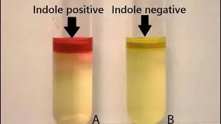 ‎بكتيريا عملى (الاختبارات البيوكيميائية-الجزء الثانى) Practical Bacteriology (Biochemical Tests- II)