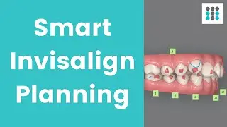 SMART INVISALIGN PLANNING REDUCES TREATMENT TIME: Patient Case Study l Dr. Bailey