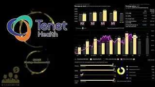 $THC Tenet Healthcare Q2 2025 Earnings Conference Call