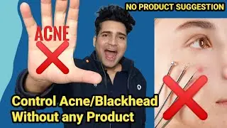 CONTROL YOUR ACNE AND BLACKHEADWITHOUT ANY PRODUCT |SKIN CARE ROUTINE TIPS #acnetreatment