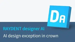 RAYDENT designer AI - AI design exception in crown