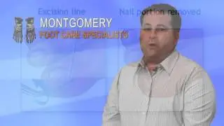 Montgomery Foot Care Specialists: Ingrown Toenails