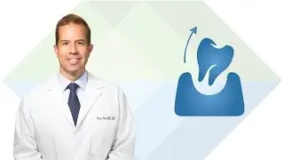 Dental Extractions in South Jordan UT: Dr. Price | Utah Facial & Oral Surgery