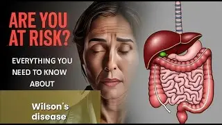 Wilson's disease Explained Causes, Symptoms and Treatment, All Insights