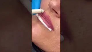 CRC Tattoo Remover lip makeup removal NYC
