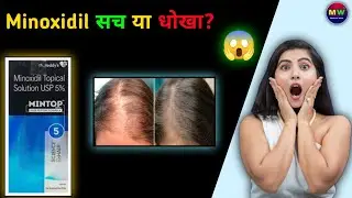 Minoxidil lotion सच या धोखा? | Hair Fall Cure Ya Marketing Trick? | Full Truth Explained