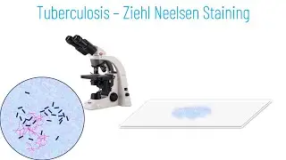 Ziehl Neelsen Staining Principle and Procedure