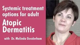 Systemic treatment options for adult Atopic Dermatitis