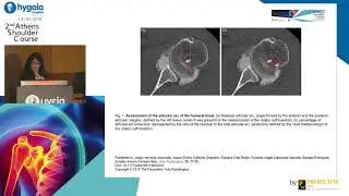Margarita Natsika - Bone defects. Radiologic evaluation with CT