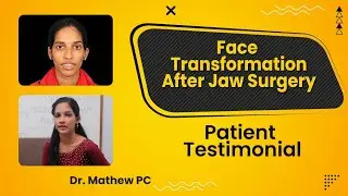 Face Transformation after Jaw Surgery in India - Patient Testimonial | Dr Mathew PC