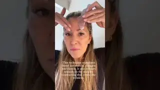 Say Goodbye to Botox: Discover Natural Anti-Aging Solutions