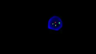 Fluorescence In Situ Hybridization (FISH) Technique