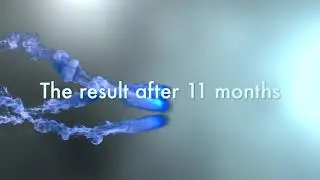Haartransplantation T&uuml;rkei HLC 3200 Gr. repair