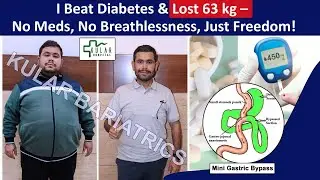 Mini Gastric Bypass Surgery Gave Me My Life Back &ndash; 63 kg Lost, No More Meds!! @kskular