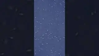 СПЕРМАТОЗОИДЫ ПОД МИКРОСКОПОМ