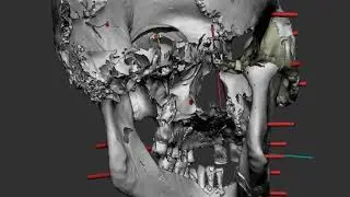 3D Facial Reconstruction