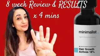 Обзор Minimalist Hair Growth Actives: результат за 8 недель | Моё честное мнение о выпадении и ро...