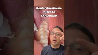 Dental Anesthesia: Everything You NEED to KNOW | View Mobile Dental