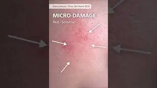Glow Killer Products 😱 Scrubs & Alcohol (Pt 6/10) Sherry Beauty         #beauty #skincare