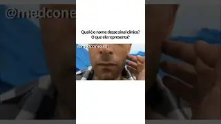 🤓Voc&ecirc; j&aacute; ouviu falar do sinal de Chvostek?