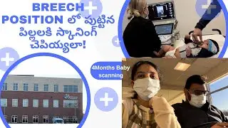 బ్రీచ్ పొజిషన్ లో పుట్టిన పిల్లలకి స్కానింగ్ చెపియ్యలా! || Sahrudh Scanning || Telugu vlogs in USA