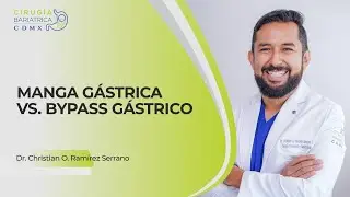 ¿Manga gástrica o ByPass Gástrico?