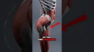 Fix Anterior Pelvic Tilt Fast (Simple Exercise That Works)