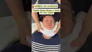 Multiple injuries: ￼ three bulging discs in the neck ￼