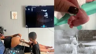 Cyn Santana & Kwame Onwuachi Welcome Baby Girl! Heartwarming Family Update 🍼✨