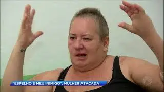 Mulher fica com graves sequelas após ser atacada pelo marido com uma faca
