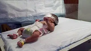 Physiotherapy for baby 🐥