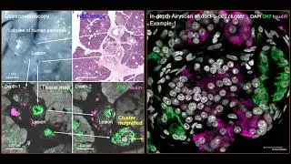 3D/Airyscan super-resolution imaging of human pancreatic duct-b-cell cluster (with music, 1080p HD)