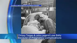 Chrissy Teigen & John Legend Have Lost Their Baby Son
