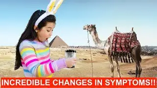 Camel Milk Is SUPERIOR For ASD Autistic Symptoms?!! Autism Spectrum Disorder