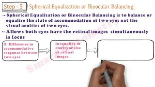 Steps of Binocular Subjective Refraction (within 3:30 mins)