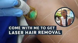 I Finally Tried Laser Hair Removal | My Experience Revealed