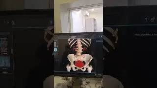 CT IVU SCAN#ytshorts #youtubeshorts #new  #chotaalivlogs #explore  #trendingshorts #foryou