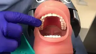Anterior Rubber Dam: placement & removal
